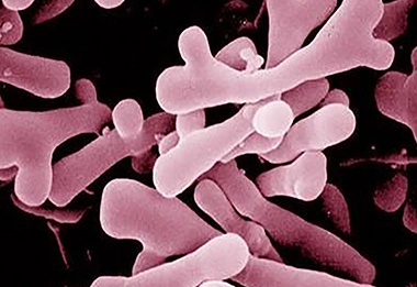 Bifidobacterium Bifidum