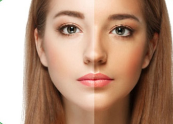 ASCORBYL TETRALSOP ALMITATE-APPLICATION FIELD